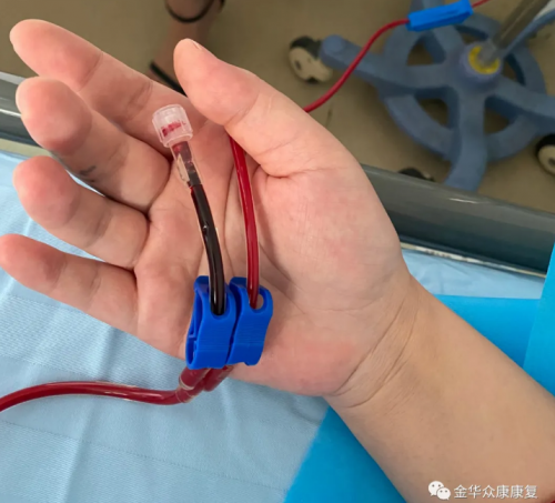 金華眾康醫(yī)院引進(jìn)特色療法：三氧自血療法！