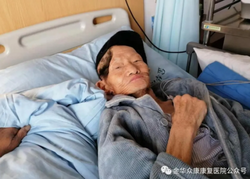 康復(fù)在線(xiàn)：額顳術(shù)后重新站起來(lái)的奇跡不再是神話(huà)