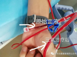 秋天腦血管疾病高發(fā)期，做對(duì)一件事就高枕無(wú)憂(yōu)了